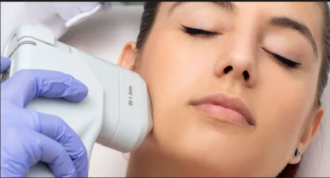 HIFU (High-Intensity Focused Ultrasound)